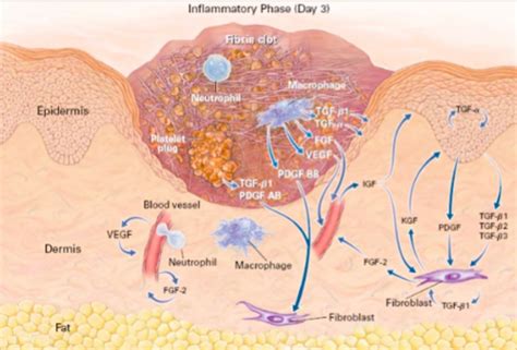 Wound Healing I Ii Flashcards Quizlet