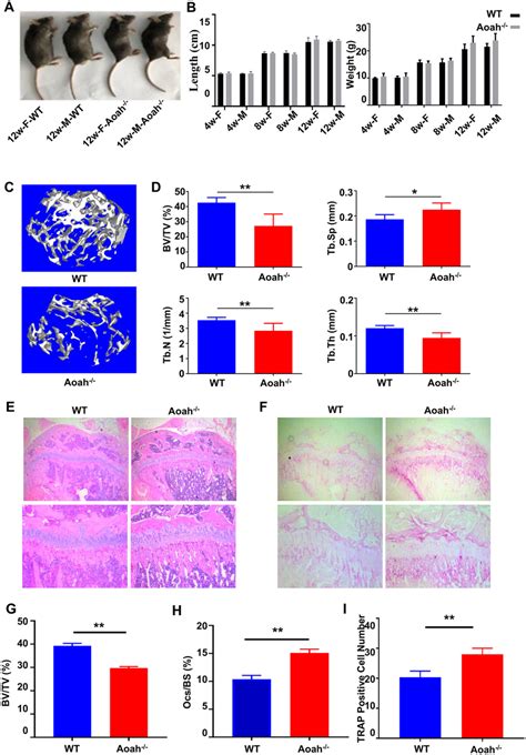 Morphometric And Histological Analysis Of Bones In Aoah And WT Mice