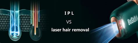 IPL VS laser hair removal – Bosidin Official Store