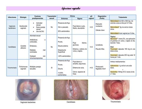 Infecciones Vaginales Angie Garcia Padilla Udocz