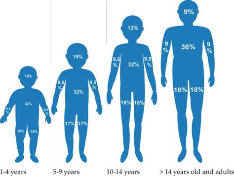 Problem Of Burns In Children Opportunities For Health Improvement