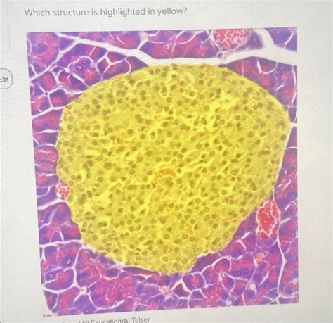 Solved 31 Which Structure Is Highlighted In Yellow Chegg