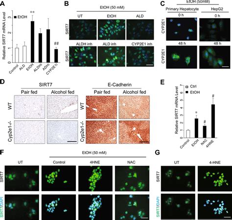 CYP2E1 Dependent Oxidative Stress Is Responsible For Alcohol Mediated