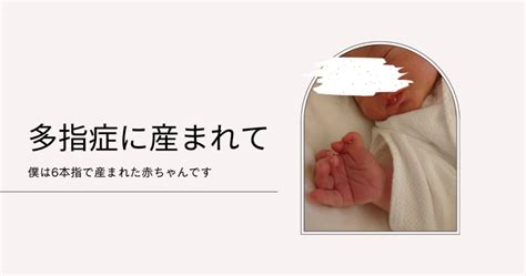 多指症、出産～赤ちゃん期の体験談。僕は6本指で産まれた赤ちゃんです。 オトクおくさま