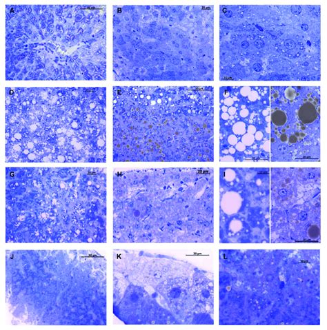 Toluidine Blue Staining Of Liver Semithin Sections Control Group Shows