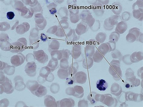 Plasmodium Under Microscope Labeled