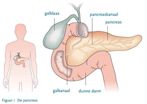 Diëtetiek Pancreatitis Amphia