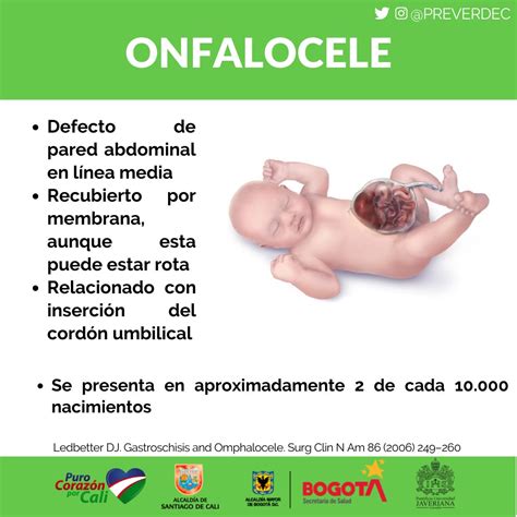 Spotlightmed Onfalocele Y Gastrosquisis Spotlightmed Off