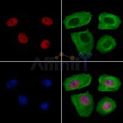 Hdac Antibody Affinity Biosciences Ltd