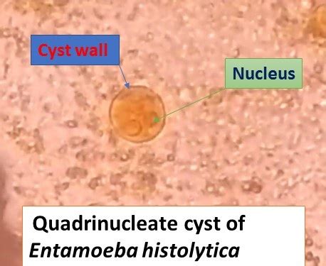 Entamoeba Histolytica Cyst And Trophozoite