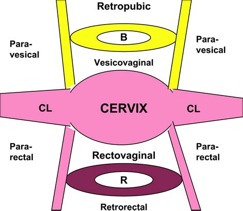 Surgical Exposure And Anatomy Of The Female Pelvis Surgical Clinics