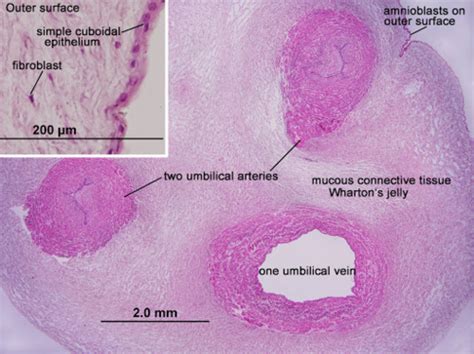 Embryonic Connective Tissue Flashcards Quizlet