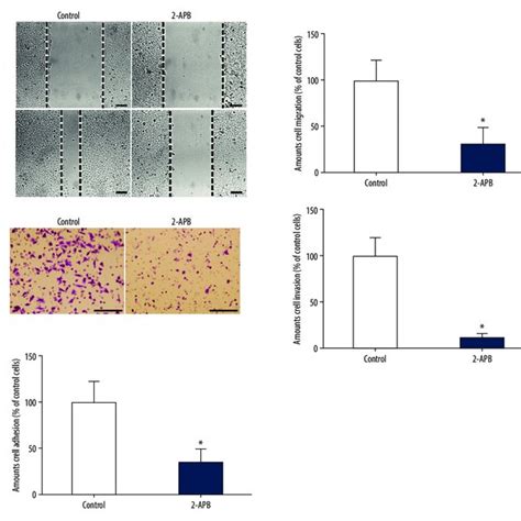 The Addition Of 2 Apb Inhibited The Migration Invasion And Adhesion