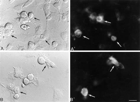 Binding Of Bodipy SRIF To COS 7 Cells Transfected With Sst 1 A And A