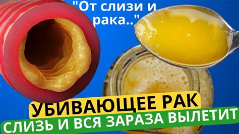 Врачи Это Скрывали! Спасёт От РАКА, Слизи и Боле в ГОРЛЕ, Кашля ...