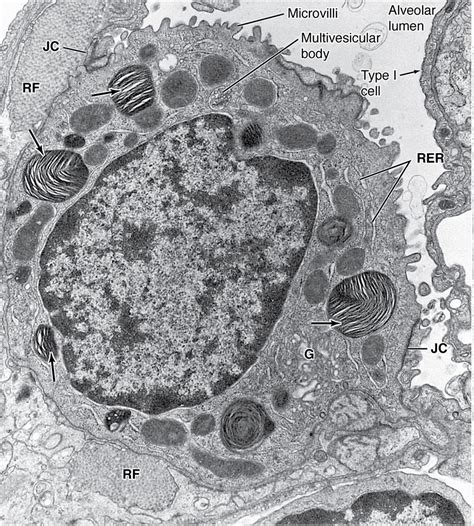 Type Ii Cells