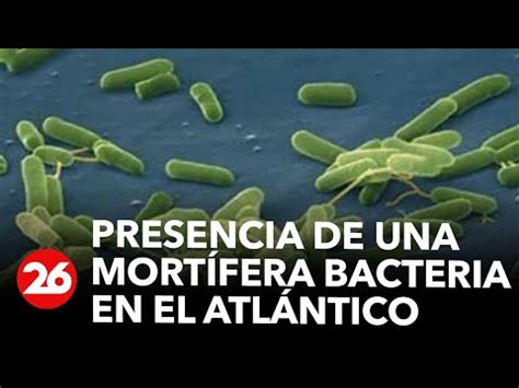 Alertan Por La Presencia De La Bacteria Come Carne En Aguas Del