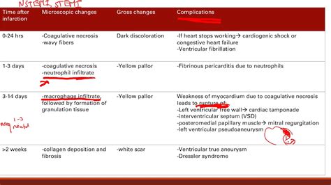 Heart Attack Complications Cardiovascular System Step 1 Simplified Youtube