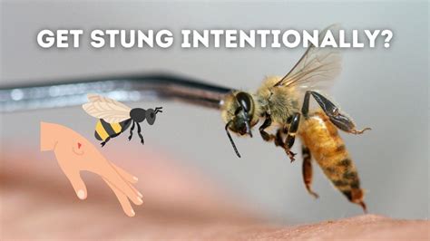 How Does Bee Stings Cure Arthritis Bee Venom Therapy Youtube