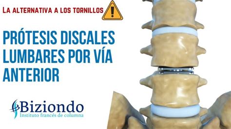 Baja por hernia discal cervical C5 C6 Causas síntomas y tratamientos