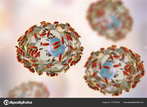 Microscopic Diagnosis Of Bacterial Vaginosis Epithelial Cell So