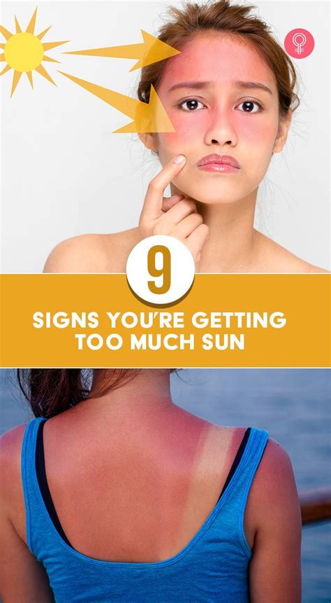 9 Signs Youre Getting Too Much Sun Red Dry Skin Skin Care Tips