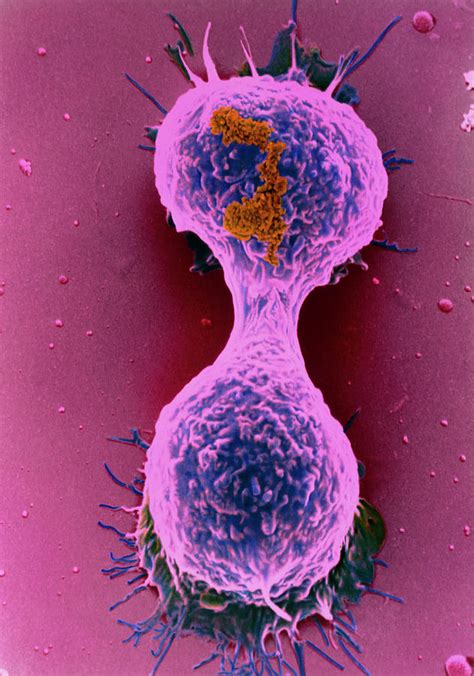 Coloured Sem Of A Dividing Breast Cancer Cell Photograph By Steve