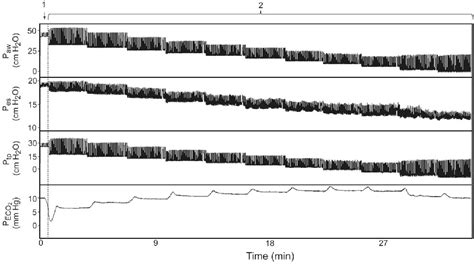 Figure 1 From Transpulmonary Pressure And Gas Exchange During