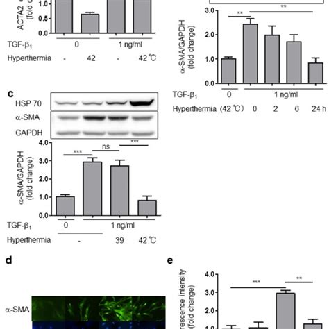 Hyperthermia inhibited α SMA protein expression in HCFs a