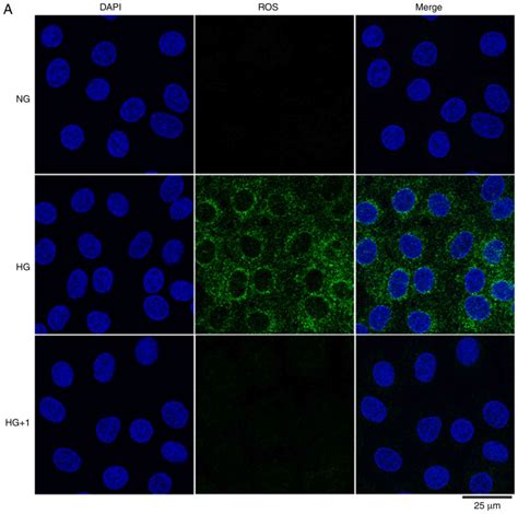 Suppression Of Hdac By Sodium Butyrate Alleviates Apoptosis Of Kidney