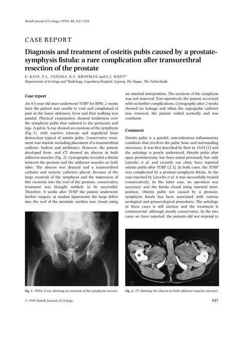 Pdf Diagnosis And Treatment Of Osteitis Pubis Caused By A Prostate