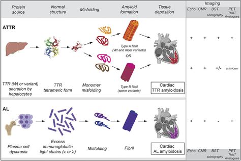 Molecular Imaging Of Cardiac Amyloidosis Journal Of Nuclear Medicine