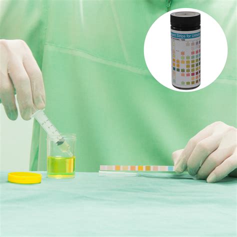 Lhx 100 Pcs Urine Ph Test Strips Urinalysis Testing Strips Urine