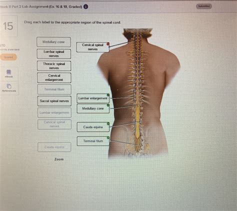 Correctly Label The Following Anatomical Features Of The Spinal Cord