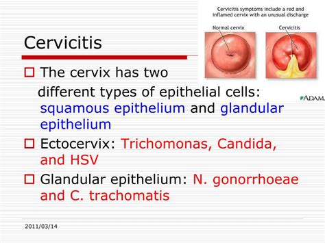 Ppt Genitourinary Infections And Sexually Transmitted Diseases