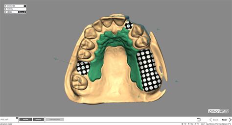 Cadcam Modellier Software Für Zahntechniker Zirkonzahn