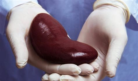 kidney transplant rejection