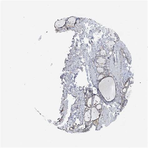 Tissue Expression Of Pdgfra Staining In Thyroid Gland The Human