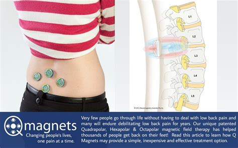 Lower Back Pain Treatment Protocol