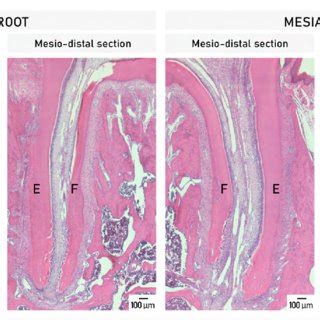 Microphotographs Of He Stained Histological Sections Of The Distal Root