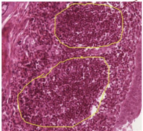 Anatomy And Histology Of Lymphoid Organs Flashcards Quizlet