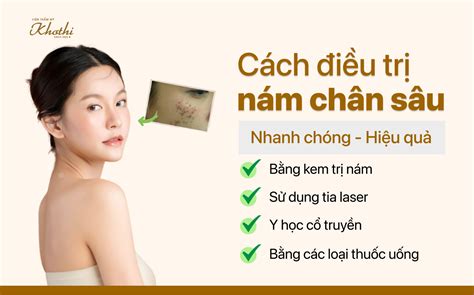 Cách điều trị nám chân sâu nhanh chóng hiệu quả