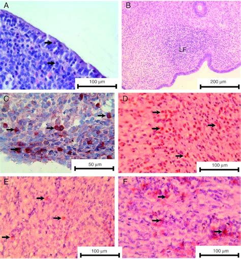 Representative Photomicrographs Of Post Partum Bovine Endometrium