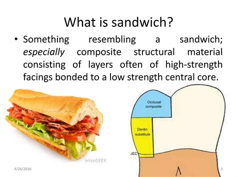 Sandwich technique | PPT