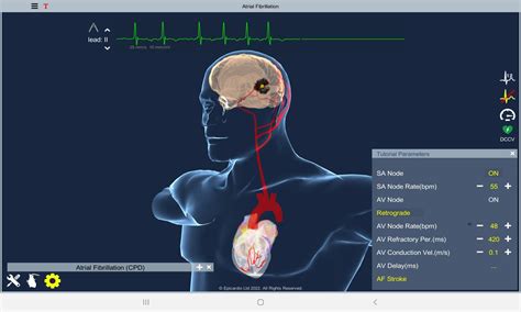 Atrial Fibrillation Latest Version 5 for Android