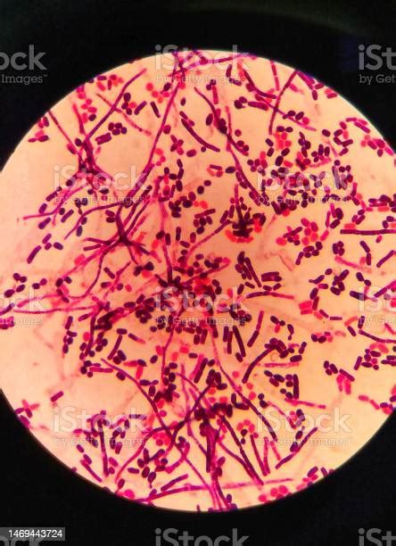 Yeast Cells And Hyphae In Gram Stain Fine With Microscope Stock Photo - Download Image Now - iStock