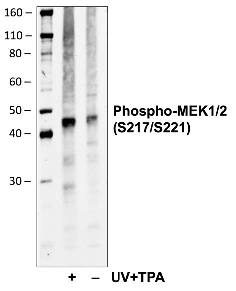 Phospho Mek12 Ser217221 Clone H2 Rabbit Mab Pd L1 Elisa Kit