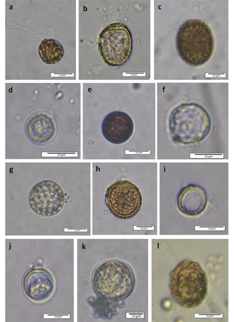 Euglenozoa A Trachelomonas Scabra Var Coberensis B Trachelomonas