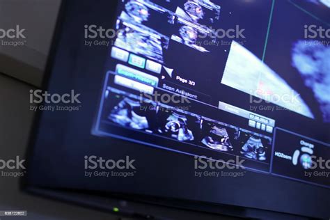 3d Ultrasound Picture Of Baby Stock Photo - Download Image Now - Baby ...