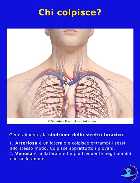 Cooperativa Fuga Amico Di Penna Gonfiore Tra Collo E Clavicola Moschea